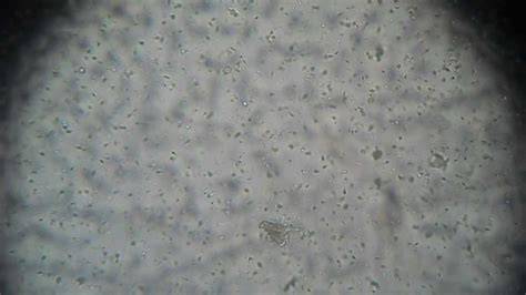 microscopio con una muestra de semen preparada para su análisis, mostrando espermatozoides en movimiento.