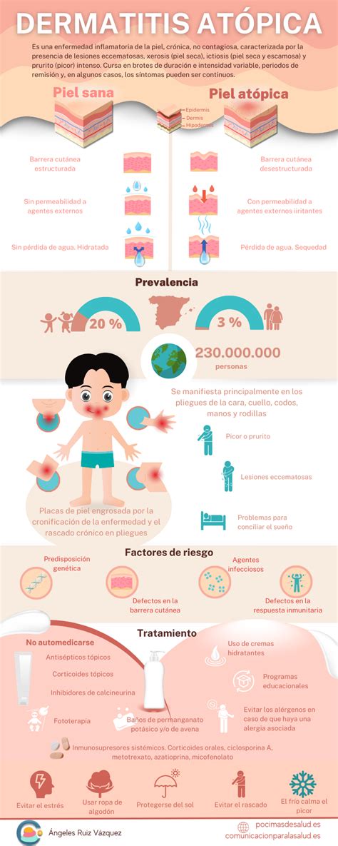 Infografía comparativa de diferentes tipos de tratamientos para la dermatitis del pañal: cremas barrera, corticoides, antifúngicos.