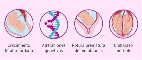 Infografía sobre causas de muerte fetal intrauterina