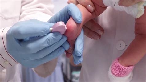 Fotografía de un profesional sanitario realizando la prueba del talón a un recién nacido