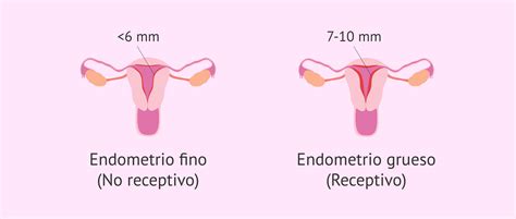 Microscopía de un endometrio receptivo