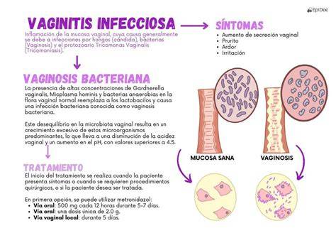 Infografía sobre las causas de la vaginitis no infecciosa