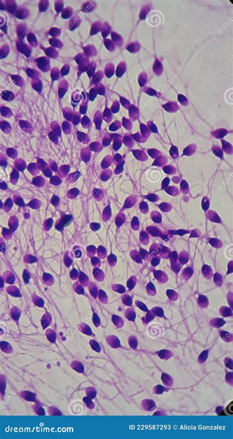 microfotografía de espermatozoides con diferentes morfologías