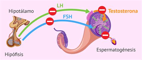 Esquema de los factores masculinos: pretesticular, testicular, postesticular y espermático.