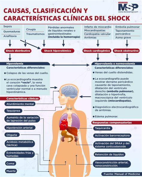 Esquema de las causas y efectos del shock en el embarazo