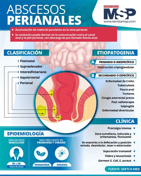 Esquema de la anatomía perineal y tipos de episiotomía/desgarro