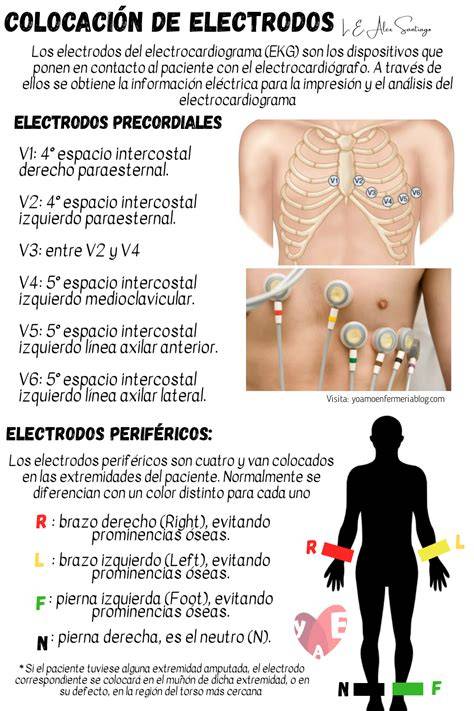 Infografía comparativa: Colocación de electrodos en adultos frente a la posición anterior/posterior recomendada para niños de menos de 25 kg.
