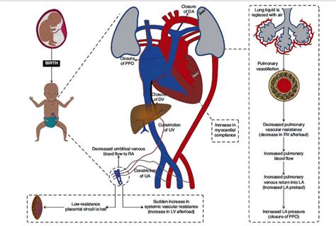 Esquema de la transición neonatal: del ambiente intrauterino a la vida extrauterina y los cuidados inmediatos.