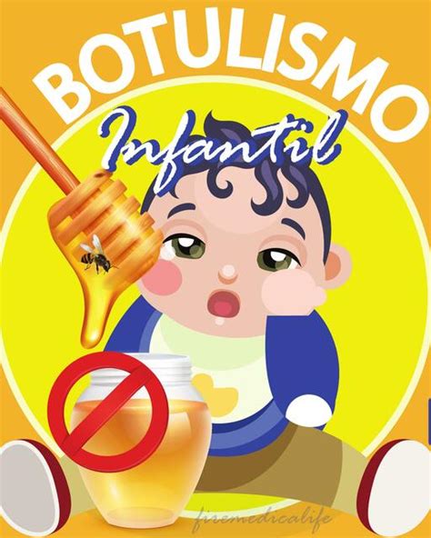 Infografía sobre los riesgos del botulismo infantil por consumo de miel en bebés