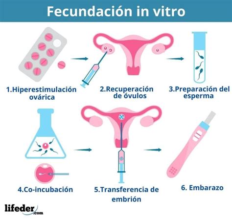 Esquema comparativo de la fecundación in vitro con óvulos propios y de donante