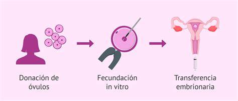 Representación gráfica del proceso de ovodonación