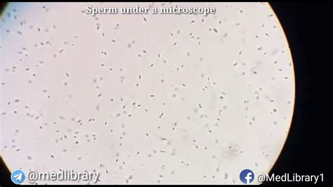 imagen de un hombre con sobrepeso y un microscopio mostrando espermatozoides