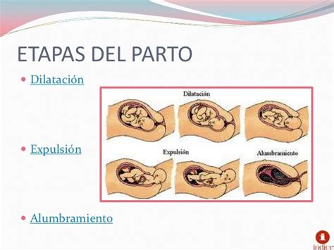 Infografía detallada con las tres fases del parto: dilatación, expulsivo y alumbramiento