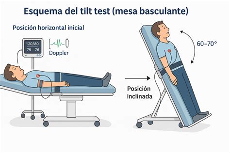 Esquema de la prueba de la mesa basculante (Tilt-test)