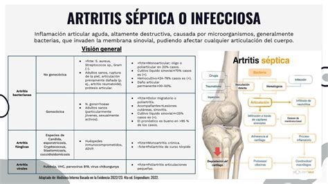 Esquema de las articulaciones más comunes afectadas por artritis séptica en niños