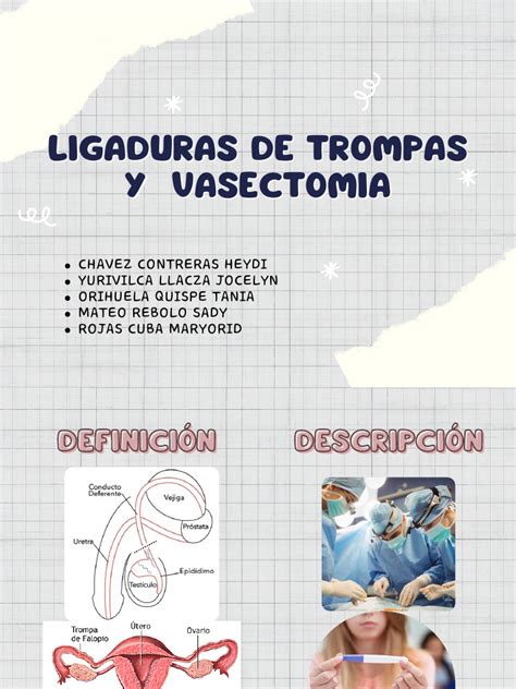 Infografía comparando la prevalencia de ligadura de trompas y vasectomía en Uruguay