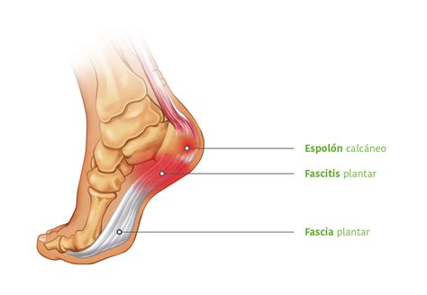 Esquema anatómico de la fascia plantar y el pie