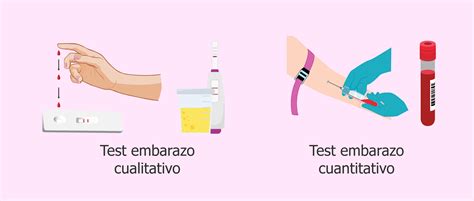 Diagrama comparando la sensibilidad y método de las pruebas de embarazo en orina y en sangre