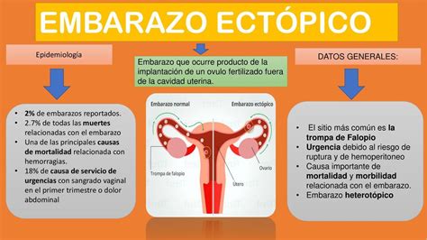 Diagrama que ilustra la diferencia entre un embarazo intrauterino normal y un embarazo ectópico
