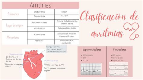 Gráfico mostrando la prevalencia de distintos tipos de arritmias maternas durante el embarazo
