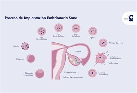 Esquema del útero y el endometrio con un embrión implantando