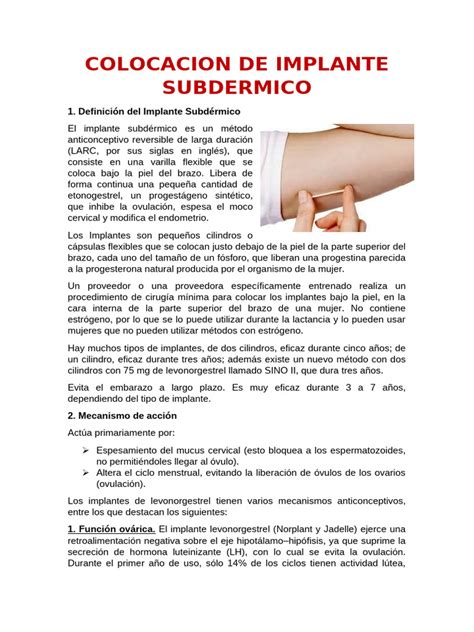 Esquema de la inserción de un implante anticonceptivo subdérmico en el brazo