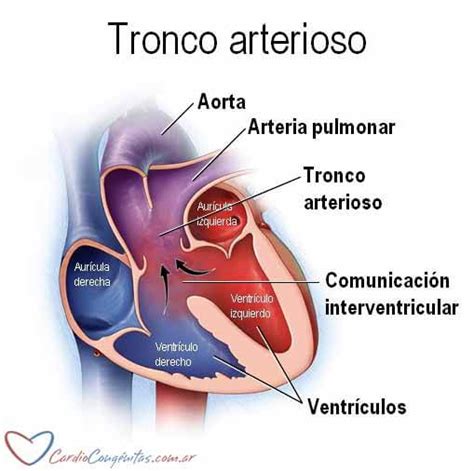 Ilustración detallada de la septación del tronco arterioso y cono arterial