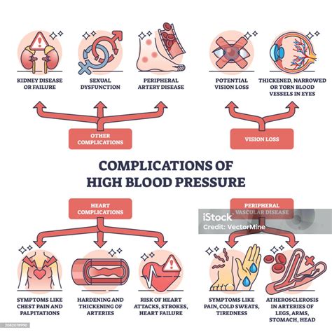 Esquema de las principales complicaciones intraparto