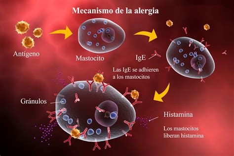 Esquema de la reacción alérgica con intervención de IgE e histamina