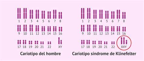 Esquema de cariotipo 47,XYY comparado con 46,XY