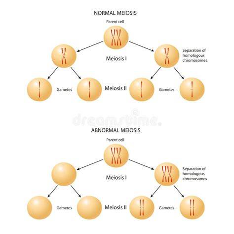 Ilustración de la no disyunción cromosómica durante la meiosis paterna