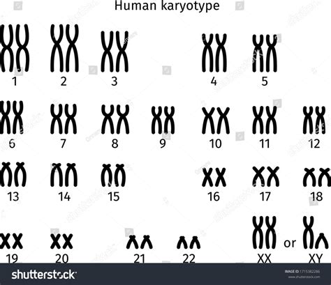 Imagen de un cariotipo humano mostrando 47,XYY