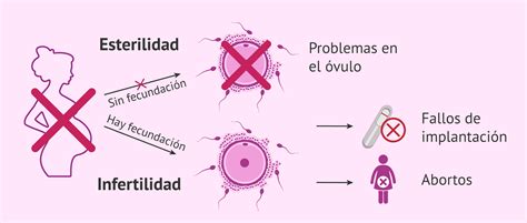 Esquema de las causas de infertilidad en parejas