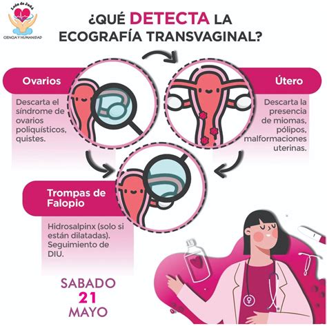 Ecografía transvaginal de útero y ovarios