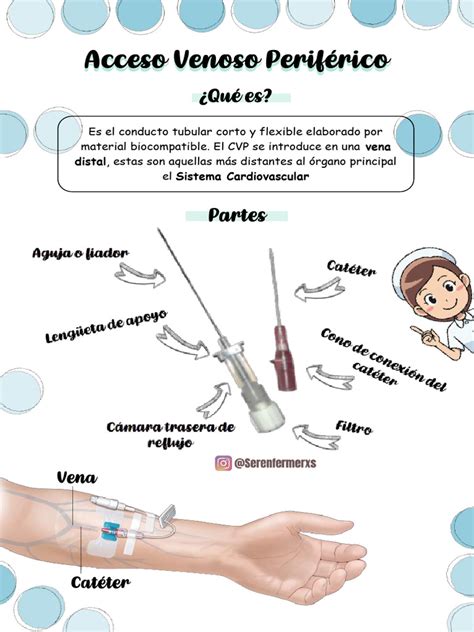 Esquema de las partes de un catéter venoso periférico