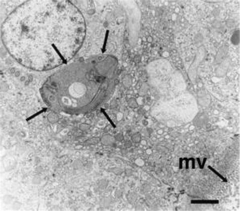 Micrografía de Spironucleus meleagridis en un raspado intestinal