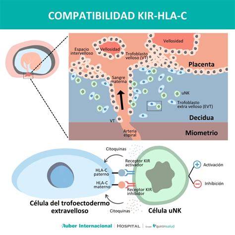 Tabla comparativa de las combinaciones KIR-HLA-C y su impacto en la receptividad uterina