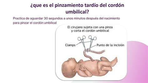 Esquema que muestra la diferencia entre el pinzamiento precoz y el pinzamiento tardío del cordón umbilical y su impacto en la transferencia de sangre al recién nacido.