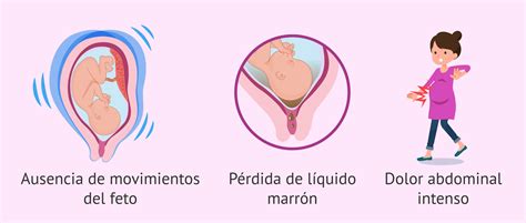 Esquema de los síntomas de la muerte fetal por trimestre