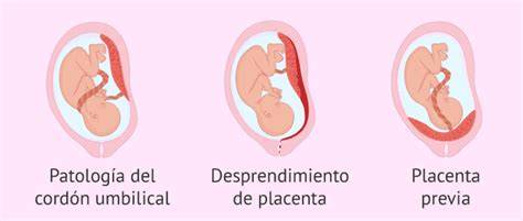 Infografía sobre las causas fetales, maternas y placentarias de la muerte fetal