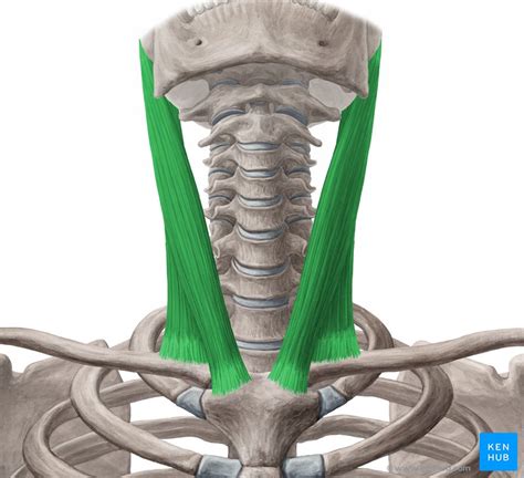 Ilustración del músculo esternocleidomastoideo en un bebé