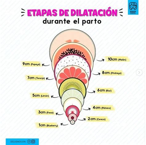 Infografía comparativa entre el procedimiento de Dilatación y Evacuación (D&E) y la inducción médica del parto