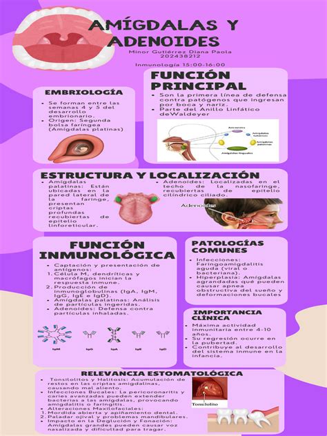 Esquema de las amígdalas y adenoides, destacando su rol en el SAOS