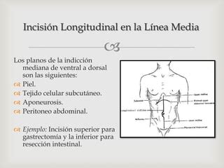 Ilustración comparativa de la incisión de línea media y la incisión mediolateral en una episiotomía.