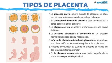 Ilustraciones comparativas de los diferentes tipos de placentas según su morfología (difusa, cotiledonaria, zonaria, discoidal).