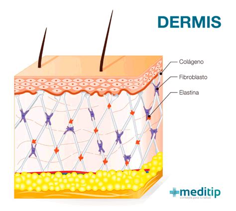 Ilustración de las capas de la piel, destacando la dermis superficial.