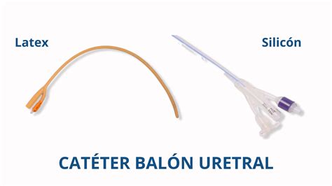 Diagrama ilustrativo del catéter de balón para la inducción mecánica del parto.