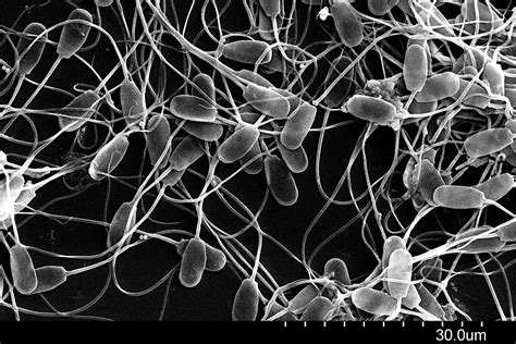 Infografía comparativa: lo que se ve (plasma seminal) vs. lo que es importante para la fecundación (espermatozoides).