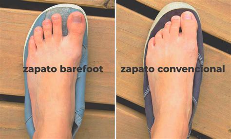 Esquema de un pie infantil y los beneficios del calzado barefoot