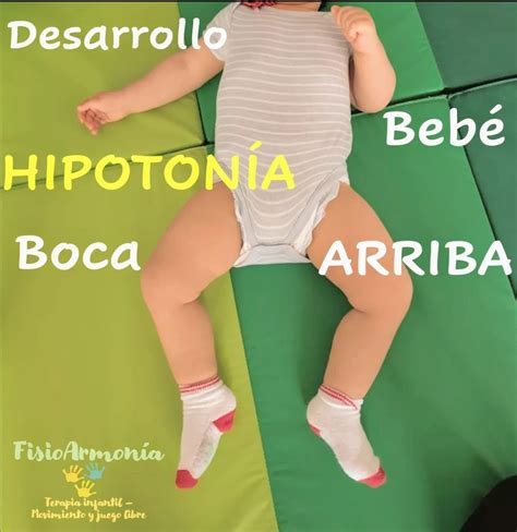 Bebé con apariencia flácida (hipotonía)